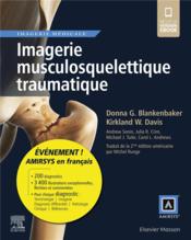 Imagerie musculosquelettique traumatique  - Collectif - Donna G. Blankenbaker - Kirkland W. Davis 