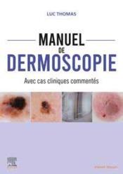 Vente livre :  Manuel de dermoscopie : avec cas cliniques commentés  - Luc Thomas 