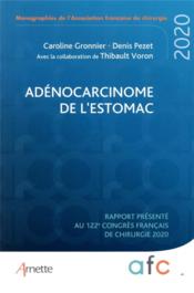 Adénocarcinome de l'estomac ; rapport presente au 122e congrés français de chirurgie (édition 2020)  - Gronnier/Pezet - Denis Pezet - Caroline Gronnier 