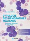Vente  Cytologie des hémopathies malignes ; anomalies sanguines et médullaires  