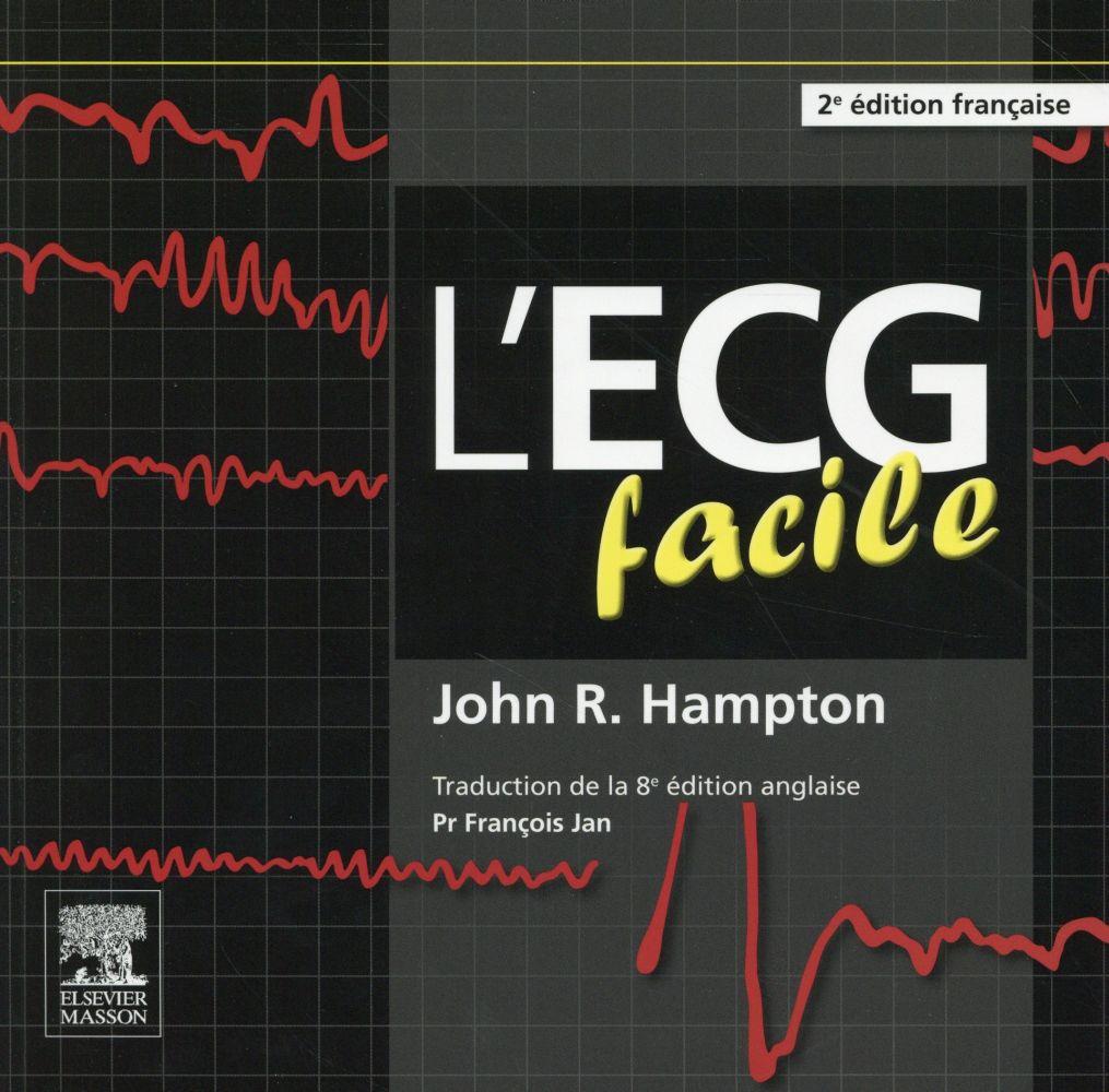 L Ecg Facile 2e Edition John R Hampton L Ecg Facile 2e Edition John R Hampton