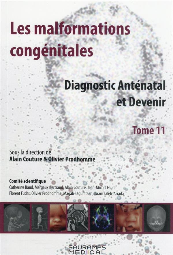 Vente  Les malformations congenitales t.11 : diagnostic anténatal et devenir  - Prudhomme  - Alain Couture  