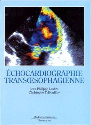Echocardiographie transoesophagienne