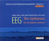 Atlas of electroencephalography v.2 ; the epilepsies, EEG and epileptic syndromes (2e édition)  - Arielle Crespel - Philippe Gelisse 