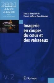 Imagerie en coupes du coeur et des vaisseaux t.2  - Francis Joffre - Pascal Guéret 