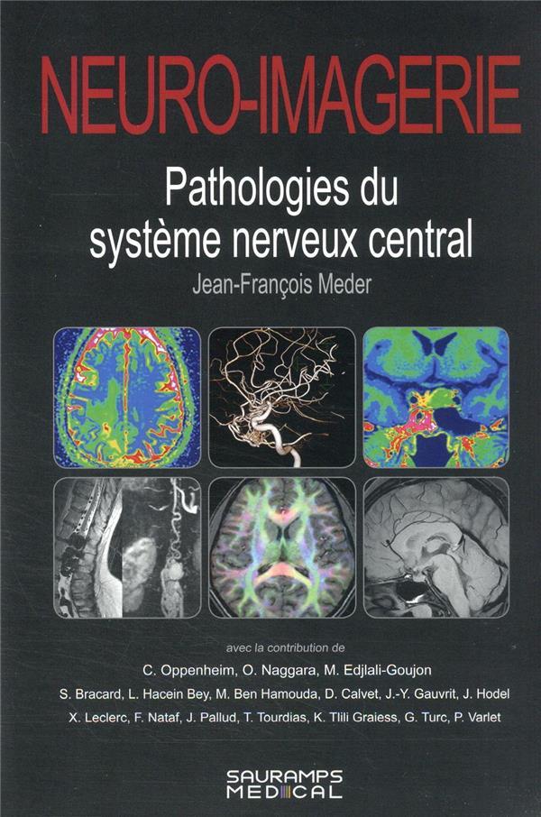 Vente  Neuro-imagerie : pathologies du système nerveux central (2e édition)  - Collectif  