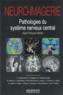 Neuro-imagerie : pathologies du système nerveux central (2e édition)